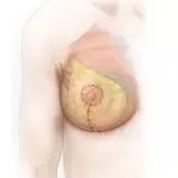 Ridicarea si remodelarea sanului